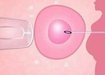 2026重庆试管婴儿医院成功率排名，哪家医院成功率高？