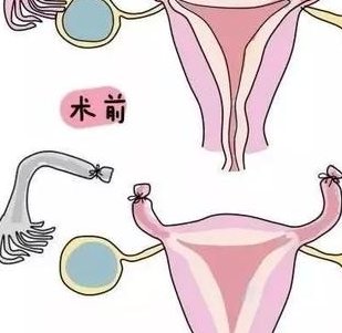 南阳中心生殖不孕不育（南阳中心医院不孕不育哪个医生看的好）