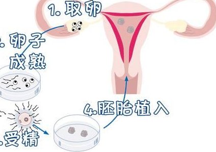 泰国雪藏卵有哪些弊端呢？该怎样去规避呢？